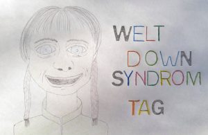 Down-Syndrom